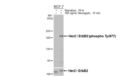 Anti-Her2 / ErbB2 (phospho Tyr877) antibody used in Western Blot (WB). GTX133605
