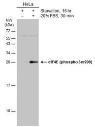 Anti-eIF4E (phospho Ser209) antibody used in Western Blot (WB). GTX133606