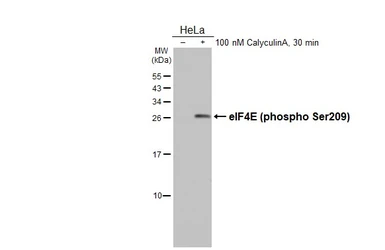 Anti-eIF4E (phospho Ser209) antibody used in Western Blot (WB). GTX133606