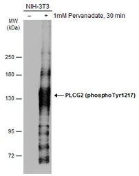 Anti-PLCG2 (phospho Tyr1217) antibody used in Western Blot (WB). GTX133610
