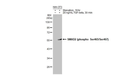 Anti-SMAD2 (phospho Ser465/Ser467) antibody used in Western Blot (WB). GTX133614