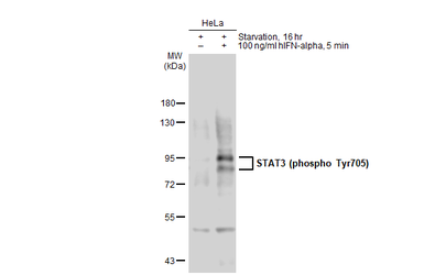 Anti-STAT3 (phospho Tyr705) antibody used in Western Blot (WB). GTX133615