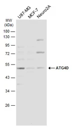 Anti-ATG4D antibody used in Western Blot (WB). GTX133617