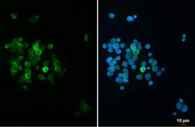 Anti-Integrin alpha 4 antibody used in Immunocytochemistry/ Immunofluorescence (ICC/IF). GTX133646