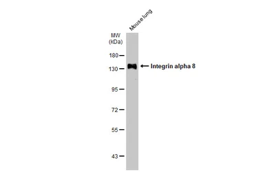 Anti-Integrin alpha 8 antibody used in Western Blot (WB). GTX133648