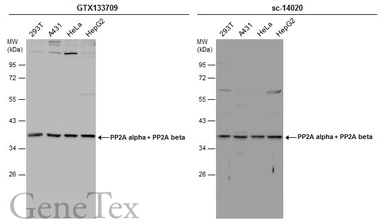 Anti-PP2A alpha + PP2A beta antibody used in Western Blot (WB). GTX133709