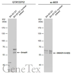 Anti-Smad1 antibody used in Western Blot (WB). GTX133712