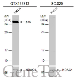 Anti-p35 antibody used in Western Blot (WB). GTX133713