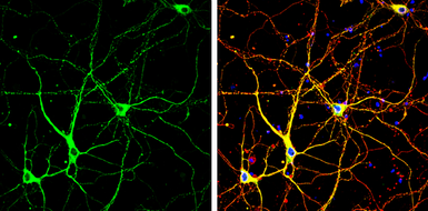 Anti-p35 antibody used in Immunocytochemistry/ Immunofluorescence (ICC/IF). GTX133713