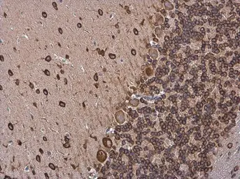 Anti-p35 antibody used in IHC (Paraffin sections) (IHC-P). GTX133713