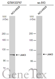 Anti-JAK3 antibody used in Western Blot (WB). GTX133717