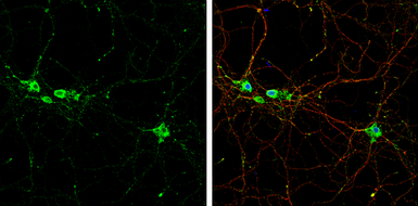 Anti-TrkB antibody used in Immunocytochemistry/ Immunofluorescence (ICC/IF). GTX133722