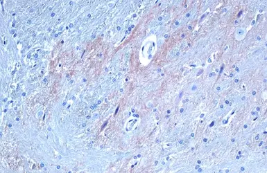 Anti-TrkB antibody used in IHC (Paraffin sections) (IHC-P). GTX133722
