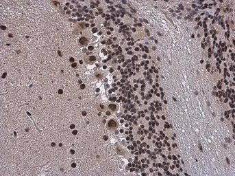 Anti-SMARCA2 antibody used in IHC (Paraffin sections) (IHC-P). GTX133724