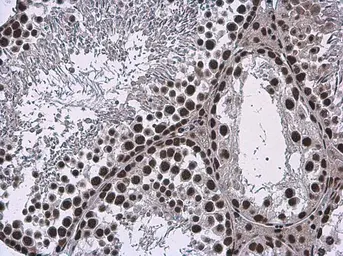 Anti-SMARCA2 antibody used in IHC (Paraffin sections) (IHC-P). GTX133724