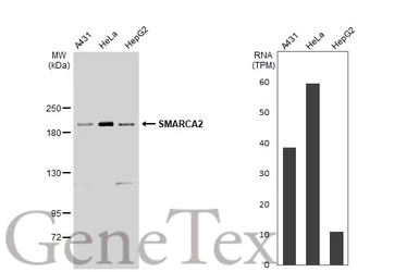 Anti-SMARCA2 antibody used in Western Blot (WB). GTX133724