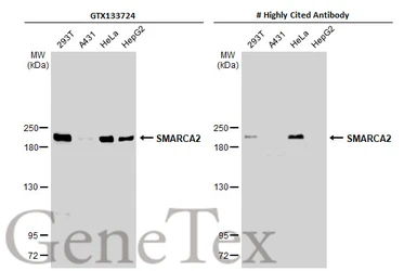 Anti-SMARCA2 antibody used in Western Blot (WB). GTX133724