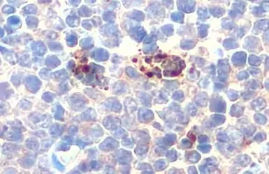 Anti-CD62P antibody used in IHC (Paraffin sections) (IHC-P). GTX133729