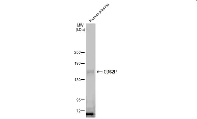 Anti-CD62P antibody used in Western Blot (WB). GTX133729