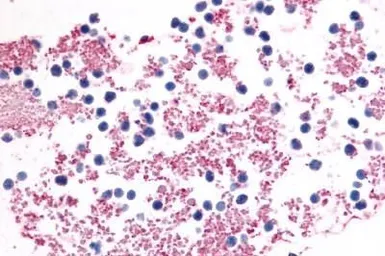 Anti-P2Y12 antibody used in IHC (Paraffin sections) (IHC-P). GTX13373