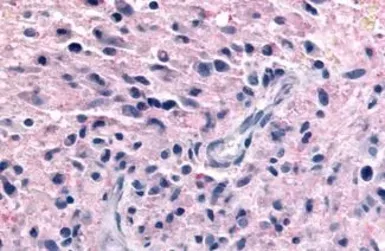 Anti-P2Y12 antibody used in IHC (Paraffin sections) (IHC-P). GTX13373
