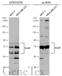 Anti-SnoN antibody used in Western Blot (WB). GTX133735