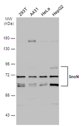 Anti-SnoN antibody used in Western Blot (WB). GTX133735