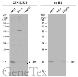 Anti-ID1 antibody used in Western Blot (WB). GTX133738