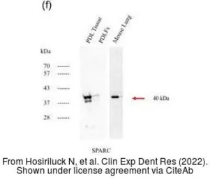 Anti-SPARC antibody used in Western Blot (WB). GTX133747