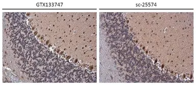 Anti-SPARC antibody used in IHC (Paraffin sections) (IHC-P). GTX133747