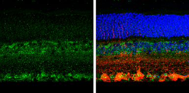 Anti-SPARC antibody used in IHC (Paraffin sections) (IHC-P). GTX133747