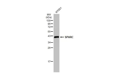 Anti-SPARC antibody used in Western Blot (WB). GTX133747