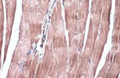 Anti-IRS2 antibody used in IHC (Paraffin sections) (IHC-P). GTX133760