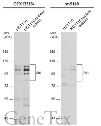 Anti-SKI antibody used in Western Blot (WB). GTX133764
