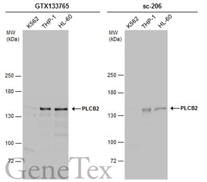 Anti-PLCB2 antibody used in Western Blot (WB). GTX133765