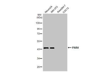 Anti-PAR4 antibody used in Western Blot (WB). GTX133766