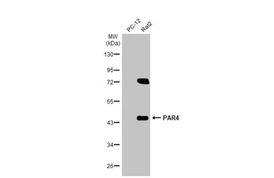 Anti-PAR4 antibody used in Western Blot (WB). GTX133766