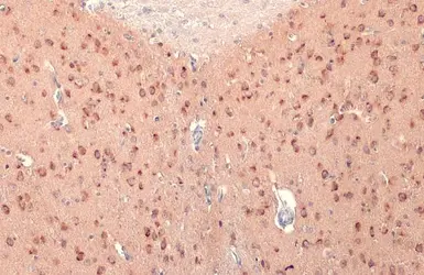 Anti-RASGRF1 antibody used in IHC (Paraffin sections) (IHC-P). GTX133775