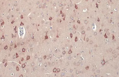 Anti-RASGRF1 antibody used in IHC (Paraffin sections) (IHC-P). GTX133775