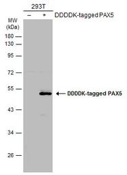 Anti-PAX5 antibody used in Western Blot (WB). GTX133777