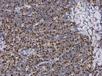 Anti-PAX5 antibody used in IHC (Paraffin sections) (IHC-P). GTX133777