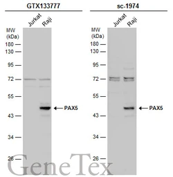 Anti-PAX5 antibody used in Western Blot (WB). GTX133777