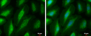Anti-PKC mu antibody used in Immunocytochemistry/ Immunofluorescence (ICC/IF). GTX133778