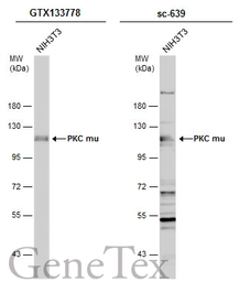 Anti-PKC mu antibody used in Western Blot (WB). GTX133778