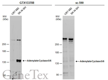 Anti-Adenylate cyclase 5/6 antibody used in Western Blot (WB). GTX133788