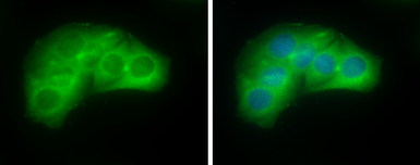 Anti-Villin antibody used in Immunocytochemistry/ Immunofluorescence (ICC/IF). GTX133791