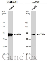 Anti-Villin antibody used in Western Blot (WB). GTX133791