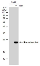Anti-Neurotrophin 4 antibody used in Western Blot (WB). GTX133792