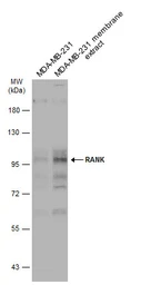 Anti-RANK antibody used in Western Blot (WB). GTX133795