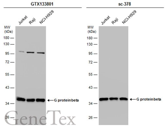Anti-G protein beta antibody used in Western Blot (WB). GTX133801